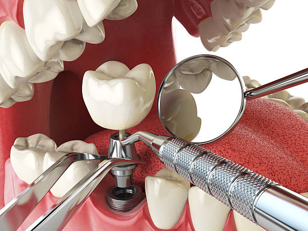 Best Emergency Cosmetic Dentistry in Crawfordville, FL