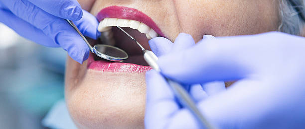 Best Emergency Dentist for Knocked-Out Tooth in Crawfordville, FL